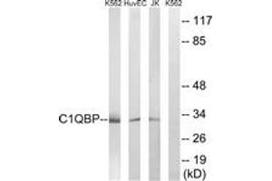 Western blot analysis of extracts from Jurkat/HuvEc/K562 cells, using C1QBP Antibody.