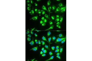 Immunofluorescence analysis of MCF7 cell using SLC22A5 antibody. (SLC22A5 antibody  (AA 1-180))