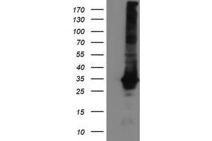 Western Blotting (WB) image for anti-Glutathione S-Transferase theta 2 (GSTT2) antibody (ABIN1498560) (GSTT2 antibody)