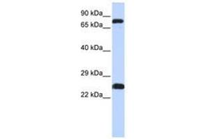 Image no. 1 for anti-Zinc Finger Protein 799 (ZNF799) (AA 111-160) antibody (ABIN6740481) (ZNF799 antibody  (AA 111-160))