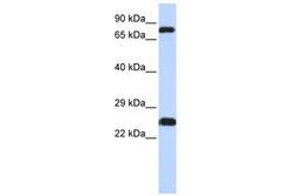 ZNF799 Antikörper  (AA 111-160)