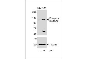 Western blot analysis of lysates from NIH/3T3 cell line, untreated or treated with UV(2h), using Phospho-RB Antibody (upper) or Tubulin (lower). (Retinoblastoma 1 antibody  (pSer612))