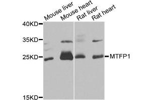 Western blot analysis of extracts of various cell lines, using MTFP1 antibody (ABIN5975088) at 1/1000 dilution. (Mtfp1 antibody)