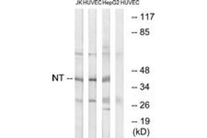 Western blot analysis of extracts from HuvEc/HepG2/Jurkat cells, using NT Antibody. (NT (AA 235-284) antibody)