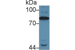 Detection of C4 in Human Serum using Polyclonal Antibody to Complement Component 4 (C4) (Complement C4 antibody  (AA 975-1336))