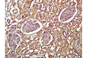 Paraformaldehyde-fixed, paraffin embedded Human kidney, Antigen retrieval by boiling in sodium citrate buffer (pH6. (Transferrin antibody)