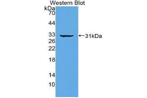 Western Blotting (WB) image for anti-Interferon Regulatory Factor 5 (IRF5) (AA 3-250) antibody (ABIN3206374) (IRF5 antibody  (AA 3-250))