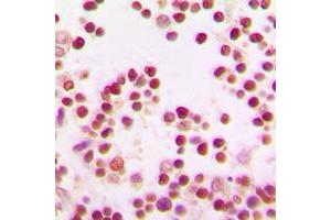 Immunohistochemical analysis of BACH1 staining in human tonsil formalin fixed paraffin embedded tissue section. (BACH1 antibody  (Center))