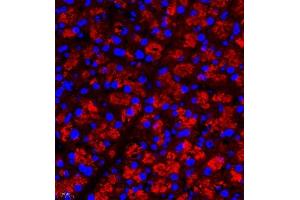 Immunofluorescence of paraffin embedded rat pancreas using Rac3 (ABIN7075378) at dilution of 1:500 (400x lens) (RAC3 antibody)
