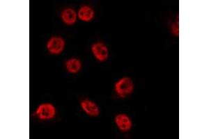 ABIN6274059 staining COS7 by IF/ICC. (TP53BP1 antibody  (pThr543))