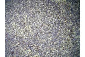 Immunohistochemistry (IHC) image for anti-CD7 (CD7) (AA 221-238), (C-Term) antibody (ABIN870611) (CD7 antibody  (C-Term))