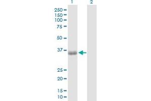 Western Blot analysis of PHF11 expression in transfected 293T cell line by PHF11 MaxPab polyclonal antibody. (PHF11 antibody  (AA 1-292))