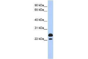 WB Suggested Anti-AK1 Antibody Titration:  0. (Adenylate Kinase 1 antibody  (Middle Region))