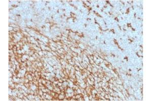 ABIN6383875 to CD14 was successfully used to stain membranes of macrophages in human lymph node and tonsil sections. (CD14 antibody  (Extracellular Domain))