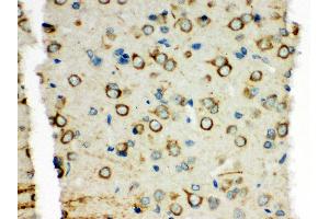 Anti-XRCC3 antibody, IHC(P) IHC(P): Rat Brain Tissue (XRCC3 antibody  (C-Term))