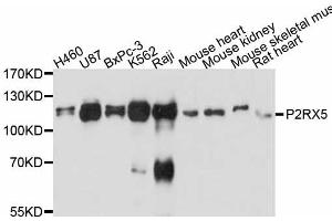 Western blot analysis of extracts of various cell lines, using P2RX5 antibody. (P2RX5 antibody)