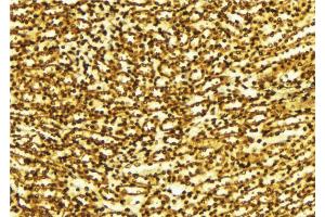 ABIN6274203 at 1/100 staining Human gastric tissue by IHC-P. (RPS6KB1 antibody  (C-Term))