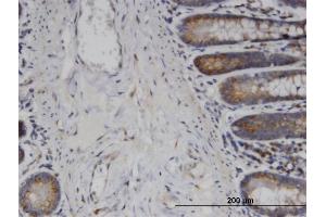 Immunoperoxidase of monoclonal antibody to USP45 on formalin-fixed paraffin-embedded human small Intestine. (USP45 antibody  (AA 106-196))