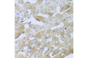 Immunohistochemistry of paraffin-embedded human liver injury using AP1M2 antibody (ABIN5974667) at dilution of 1/100 (40x lens). (AP1m2 antibody)