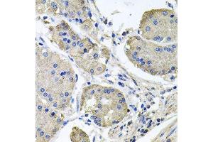 NDUFA6 antibody  (AA 35-154)