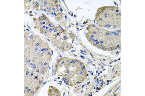 NDUFA6 antibody  (AA 35-154)
