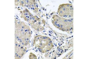 Immunohistochemistry of paraffin-embedded human stomach using NDUFA6 antibody. (NDUFA6 antibody  (AA 35-154))