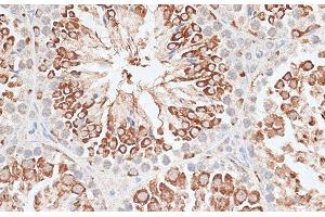 Immunohistochemistry (Paraffin-embedded Sections) (IHC (p)) image for anti-Kinesin Family Member 2C (KIF2C) antibody (ABIN7261407)