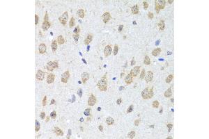 Immunohistochemistry of paraffin-embedded mouse brain using CXCL8 antibody (ABIN6290535) at dilution of 1:100 (40x lens). (IL-8 antibody)