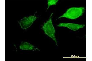 Immunofluorescence of purified MaxPab antibody to GCDH on HeLa cell. (GCDH antibody  (AA 1-438))
