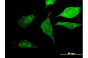 Immunofluorescence of purified MaxPab antibody to GCDH on HeLa cell.