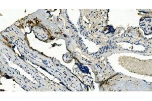 IHC analysis of TMBIM1 using anti-TMBIM1 antibody (ABIN7603190). (TMBIM1 antibody  (N-Term))