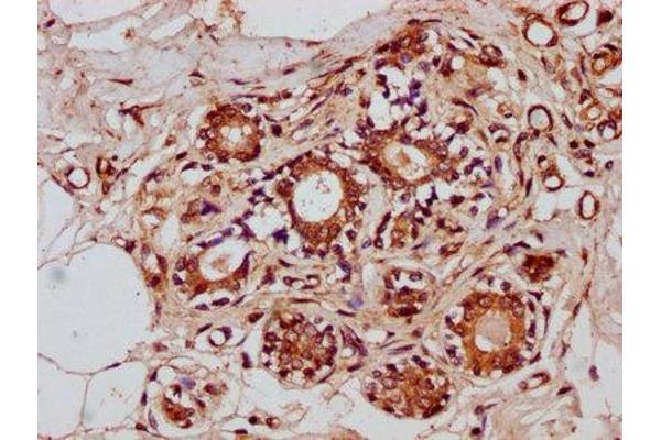ZNF3 antibody  (AA 92-210)