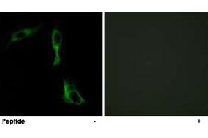 Immunofluorescence analysis of HeLa cells, using ADRA1D polyclonal antibody .