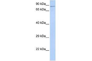 WB Suggested Anti-ZNF226 Antibody Titration:  0.