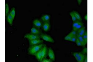 Immunofluorescent analysis of Hela cells using ABIN7145827 at dilution of 1:100 and Alexa Fluor 488-congugated AffiniPure Goat Anti-Rabbit IgG(H+L) (TNFAIP1 antibody  (AA 233-316))