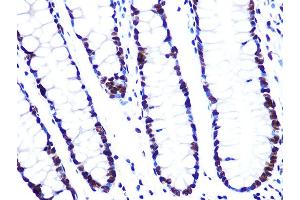 Immunohistochemistry of paraffin-embedded human colon using L Rabbit mAb (ABIN7270266) at dilution of 1:100 (40x lens). (ASH2L antibody)