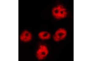 ABIN6267626 staining HeLa by IF/ICC. (FOXO1 antibody  (pSer256))