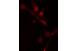 ABIN6274474 staining HepG2 cells by IF/ICC. (MASTL antibody  (C-Term))