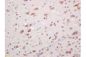 Formalin-fixed and paraffin embedded rat brain labeled with Anti-PCP4/PEP-19 Polyclonal Antibody, Unconjugated (ABIN1385742) at 1:200, followed by conjugation to the secondary antibody and DAB staining