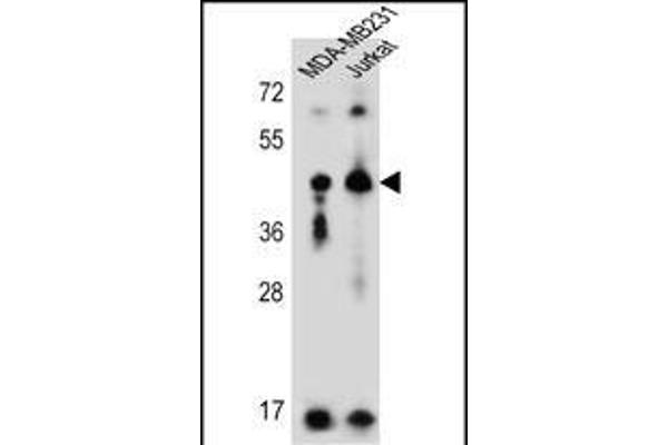 KIR2DL2 antibody  (C-Term)