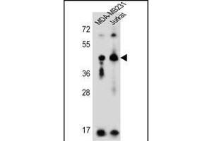 KIR2DL2 Antibody (C-Term) (ABIN651949 and ABIN2840471) western blot analysis in MDA-M,Jurkat cell line lysates (35 μg/lane). (KIR2DL2 antibody  (C-Term))