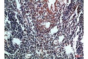 Immunohistochemical analysis of paraffin-embedded Human-tonsil, antibody was diluted at 1:100