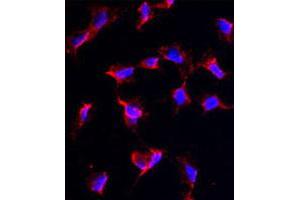 Immunofluorescence analysis of NANOS1 polyclonal antibody  in HeLa cells. (Nanos Homolog 1 antibody  (C-Term))