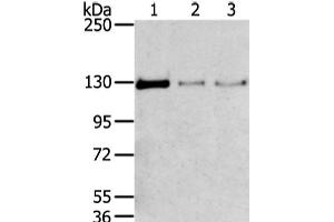 Western Blot analysis of 293T, 231 and lo2 cell using TRIM24 Polyclonal Antibody at dilution of 1/400 (TRIM24 antibody)