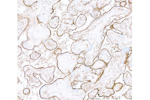 Immunohistochemistry (IHC) image for anti-Thrombomodulin (THBD) (AA 17-515) antibody (ABIN7795644)