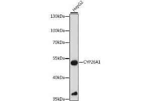Western blot analysis of extracts of HepG2 cells, using CYP26 antibody (6259) at 1:1000 dilution. (CYP26A1 antibody  (AA 50-150))