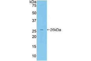 Western blot analysis of recombinant Mouse FBLN2.