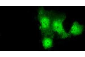 Anti-GBE1 mouse monoclonal antibody (ABIN2453066) immunofluorescent staining of COS7 cells transiently transfected by pCMV6-ENTRY GBE1 (RC204152). (GBE1 antibody)