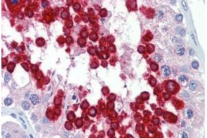 Human Testis (formalin-fixed, paraffin-embedded) stained with JAZF1 antibody ABIN462223 followed by biotinylated goat anti-rabbit IgG secondary antibody ABIN481713, alkaline phosphatase-streptavidin and chromogen. (JAZF1 antibody  (C-Term))