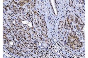 IHC analysis of YY1 using anti-YY1 antibody (ABIN7602999). (YY1 antibody  (Middle Region))